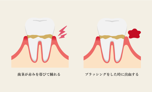 主な症状