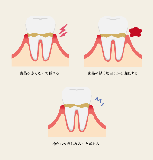 主な症状